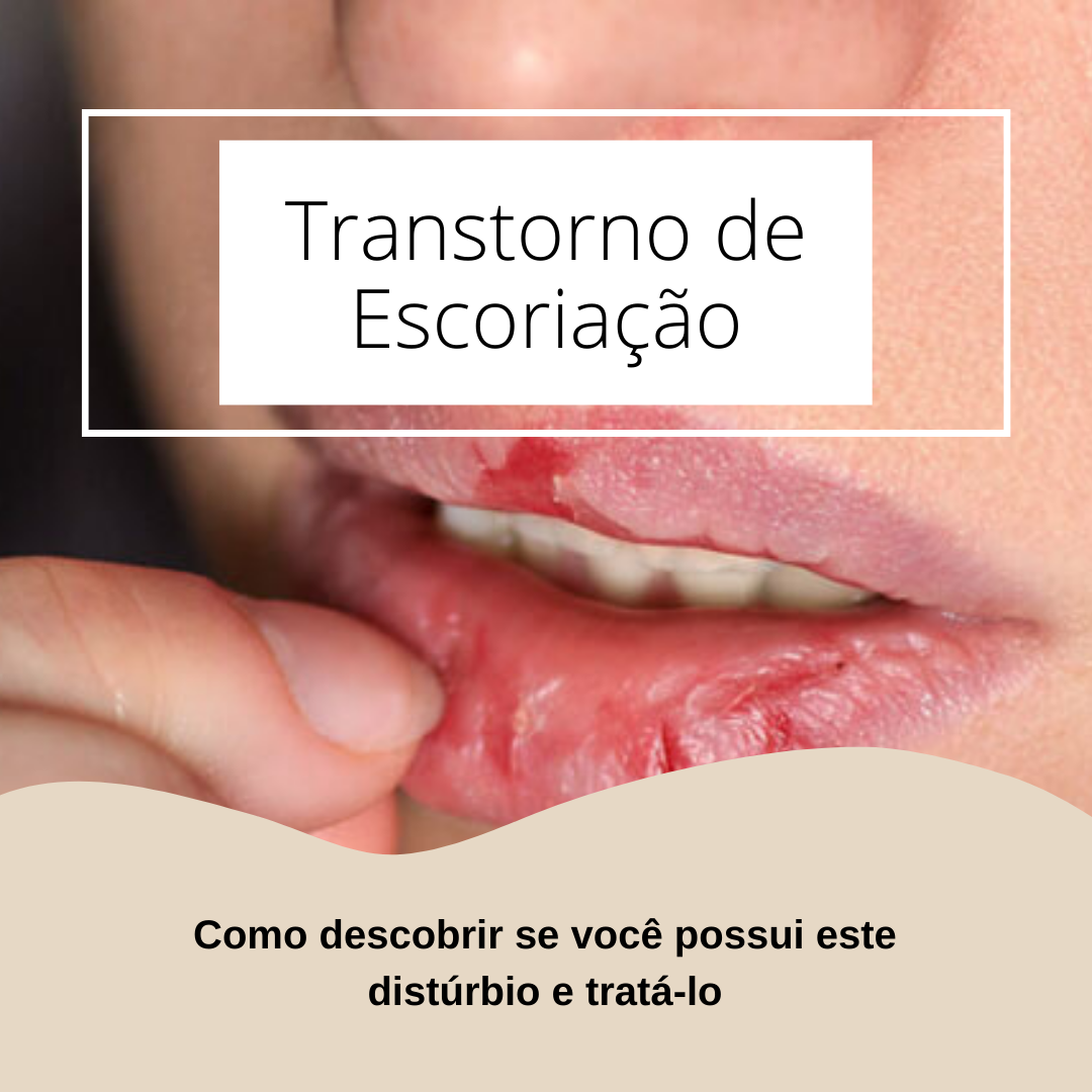 Read more about the article Transtorno de Escoriação